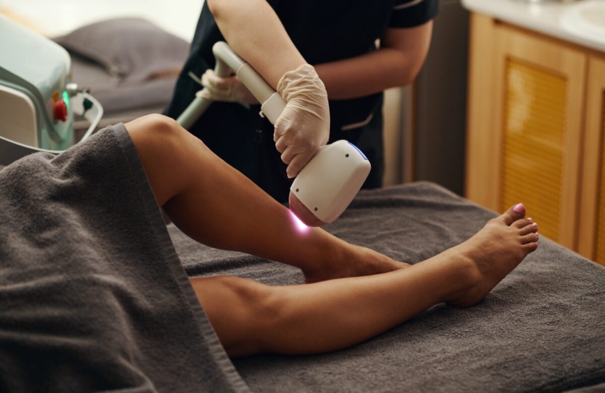 Épilation laser : fonctionnement, déroulement et résultats